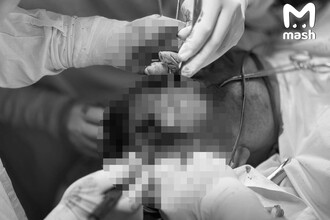 Медицинские Катастрофы: Уникальные Случаи и Последствия
